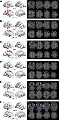More than just statics: Static and temporal dynamic changes in intrinsic brain activity in unilateral temporal lobe epilepsy